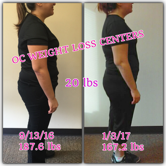weight loss