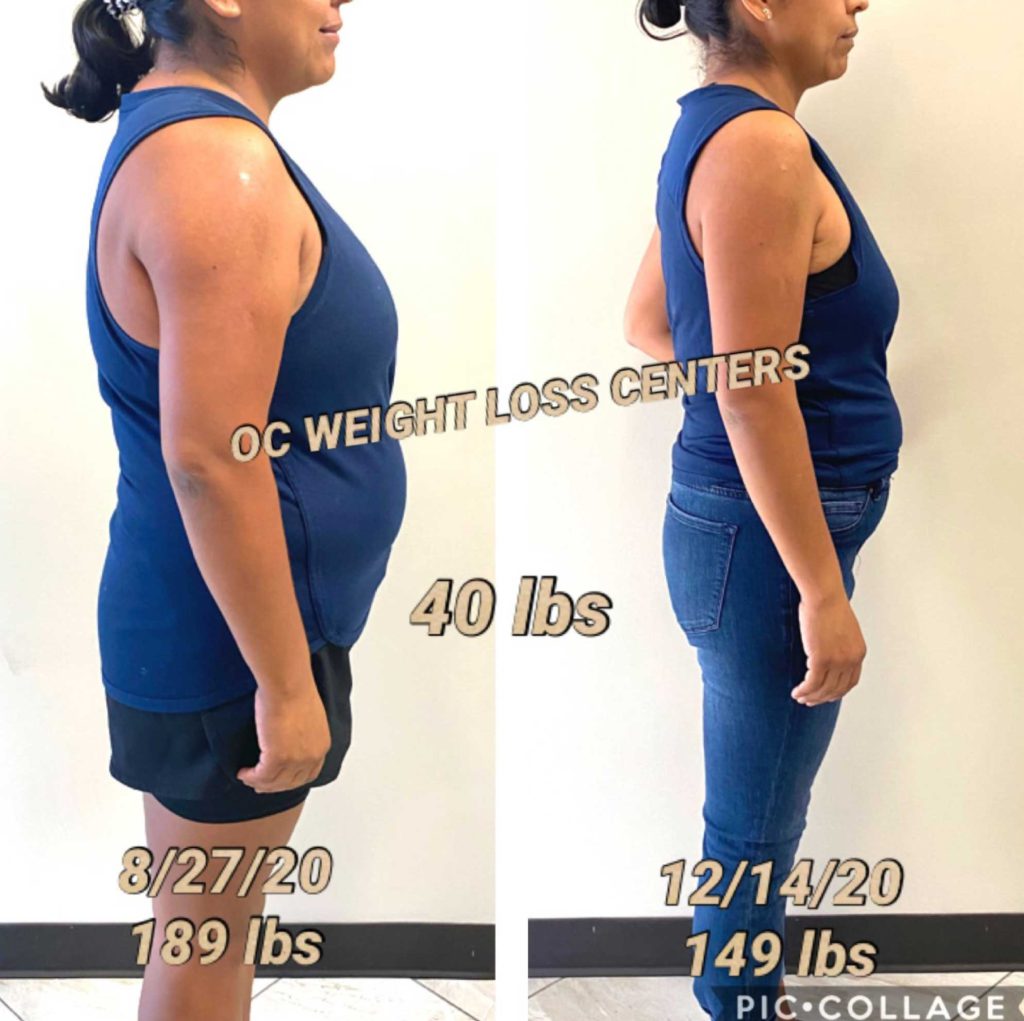 before-and-after-weight-loss-results-oc-weight-loss